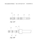 SYSTEMS FOR TREATING A HOLLOW ANATOMICAL STRUCTURE diagram and image