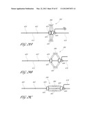 SYSTEMS FOR TREATING A HOLLOW ANATOMICAL STRUCTURE diagram and image