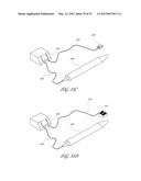 SYSTEMS FOR TREATING A HOLLOW ANATOMICAL STRUCTURE diagram and image