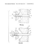 FRACTURE MANAGEMENT TOOL AND METHOD diagram and image