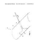 FRACTURE MANAGEMENT TOOL AND METHOD diagram and image