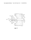 FRACTURE MANAGEMENT TOOL AND METHOD diagram and image