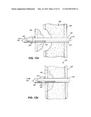 FRACTURE MANAGEMENT TOOL AND METHOD diagram and image