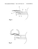 Disk Preparation Tool With Flexible Cutting Element diagram and image