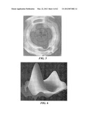 PATIENT SELECTABLE JOINT ARTHROPLASTY DEVICES AND SURGICAL TOOLS diagram and image