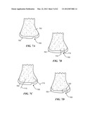 PATIENT SELECTABLE JOINT ARTHROPLASTY DEVICES AND SURGICAL TOOLS diagram and image