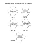 PATIENT SELECTABLE JOINT ARTHROPLASTY DEVICES AND SURGICAL TOOLS diagram and image