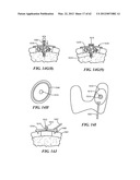 PATIENT SELECTABLE JOINT ARTHROPLASTY DEVICES AND SURGICAL TOOLS diagram and image