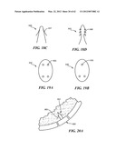 PATIENT SELECTABLE JOINT ARTHROPLASTY DEVICES AND SURGICAL TOOLS diagram and image