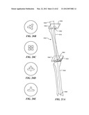 PATIENT SELECTABLE JOINT ARTHROPLASTY DEVICES AND SURGICAL TOOLS diagram and image