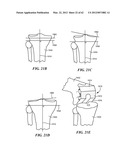 PATIENT SELECTABLE JOINT ARTHROPLASTY DEVICES AND SURGICAL TOOLS diagram and image