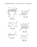 PATIENT SELECTABLE JOINT ARTHROPLASTY DEVICES AND SURGICAL TOOLS diagram and image