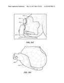 PATIENT SELECTABLE JOINT ARTHROPLASTY DEVICES AND SURGICAL TOOLS diagram and image