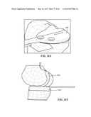 PATIENT SELECTABLE JOINT ARTHROPLASTY DEVICES AND SURGICAL TOOLS diagram and image