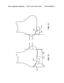 PATIENT SELECTABLE JOINT ARTHROPLASTY DEVICES AND SURGICAL TOOLS diagram and image