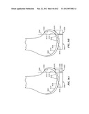 PATIENT SELECTABLE JOINT ARTHROPLASTY DEVICES AND SURGICAL TOOLS diagram and image