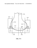 PATIENT SELECTABLE JOINT ARTHROPLASTY DEVICES AND SURGICAL TOOLS diagram and image