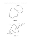 PATIENT SELECTABLE JOINT ARTHROPLASTY DEVICES AND SURGICAL TOOLS diagram and image