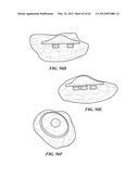 PATIENT SELECTABLE JOINT ARTHROPLASTY DEVICES AND SURGICAL TOOLS diagram and image