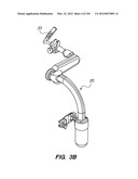 ANTI-BUCKLING MECHANISMS AND METHODS diagram and image