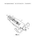 ANTI-BUCKLING MECHANISMS AND METHODS diagram and image