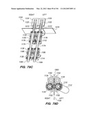 ANTI-BUCKLING MECHANISMS AND METHODS diagram and image