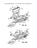 ANTI-BUCKLING MECHANISMS AND METHODS diagram and image