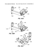 ANTI-BUCKLING MECHANISMS AND METHODS diagram and image