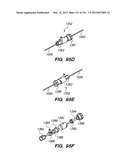 ANTI-BUCKLING MECHANISMS AND METHODS diagram and image