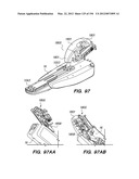 ANTI-BUCKLING MECHANISMS AND METHODS diagram and image