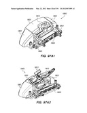 ANTI-BUCKLING MECHANISMS AND METHODS diagram and image