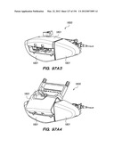 ANTI-BUCKLING MECHANISMS AND METHODS diagram and image