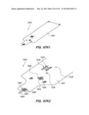 ANTI-BUCKLING MECHANISMS AND METHODS diagram and image