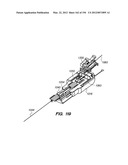 ANTI-BUCKLING MECHANISMS AND METHODS diagram and image