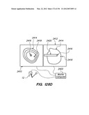 ANTI-BUCKLING MECHANISMS AND METHODS diagram and image