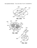 ANTI-BUCKLING MECHANISMS AND METHODS diagram and image