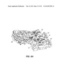 ANTI-BUCKLING MECHANISMS AND METHODS diagram and image