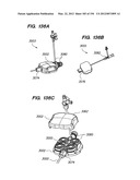 ANTI-BUCKLING MECHANISMS AND METHODS diagram and image