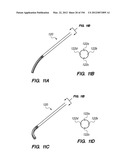 ANTI-BUCKLING MECHANISMS AND METHODS diagram and image