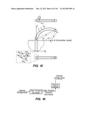 ANTI-BUCKLING MECHANISMS AND METHODS diagram and image