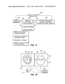 ANTI-BUCKLING MECHANISMS AND METHODS diagram and image