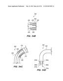 ANTI-BUCKLING MECHANISMS AND METHODS diagram and image