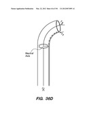 ANTI-BUCKLING MECHANISMS AND METHODS diagram and image