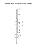 ANTI-BUCKLING MECHANISMS AND METHODS diagram and image