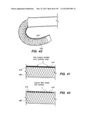 ANTI-BUCKLING MECHANISMS AND METHODS diagram and image