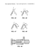 ANTI-BUCKLING MECHANISMS AND METHODS diagram and image