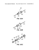 ANTI-BUCKLING MECHANISMS AND METHODS diagram and image