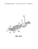 ANTI-BUCKLING MECHANISMS AND METHODS diagram and image