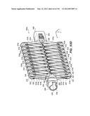 ANTI-BUCKLING MECHANISMS AND METHODS diagram and image