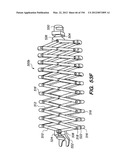 ANTI-BUCKLING MECHANISMS AND METHODS diagram and image